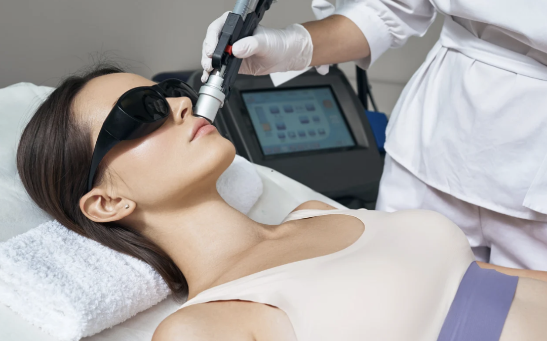 Erbium Laser Resurfacing Costs in Rockville, Maryland for Acne Scars